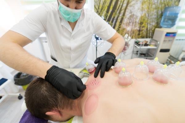 Hijama cupping therapy à domicile au Maroc, dos et bien-être