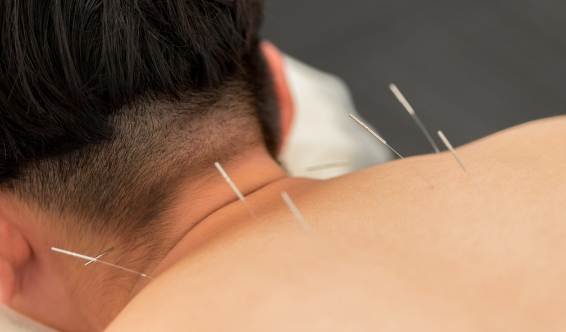 Acupuncture à domicile au Maroc sur la nuque et les épaules