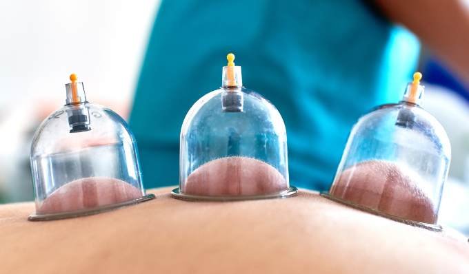 Hijama ventouses sèches dos à domicile Maroc