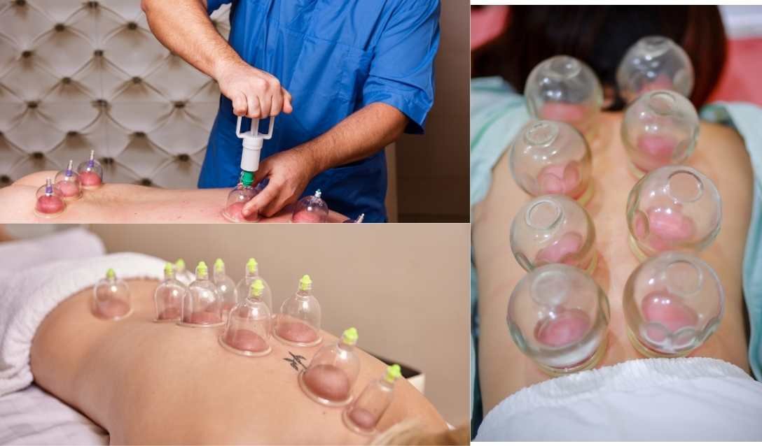 Service de hijama à domicile au Maroc — cupping therapy Rabat Casablanca Marrakech Tanger Fès Meknès